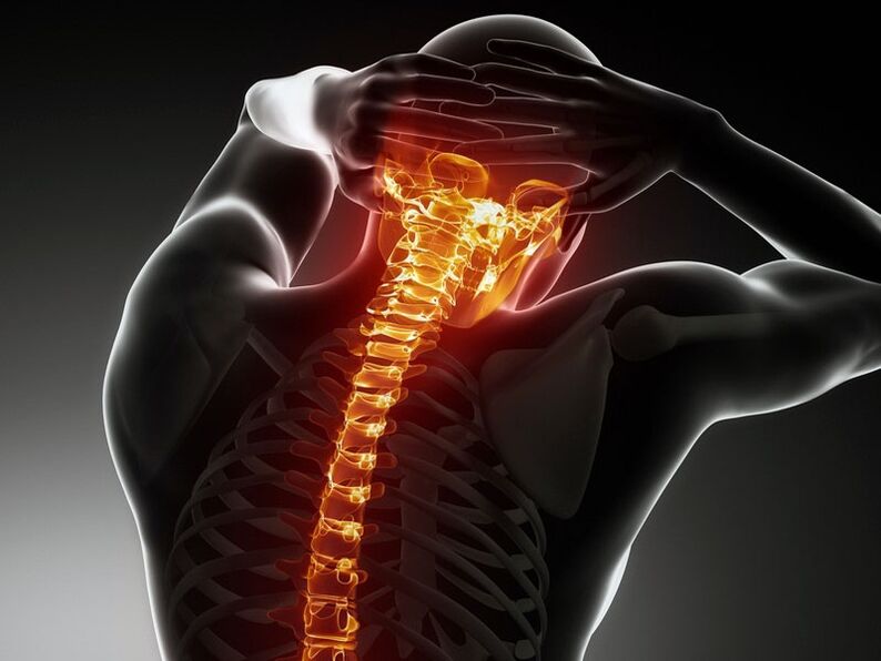 Příznaky osteochondrosy