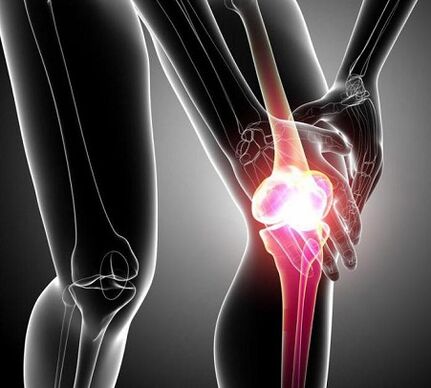 poškození kolenního kloubu s artritidou a artrózou