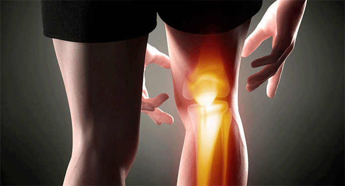 bolest kolenního kloubu