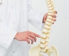 Bederní osteochondrosis