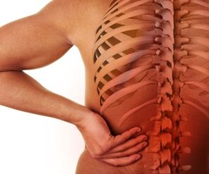 bolesti zad s bederní osteochondrózou