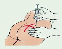 injekce pro léčbu osteochondrózy