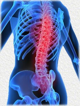 osteochondróza a způsoby její léčby